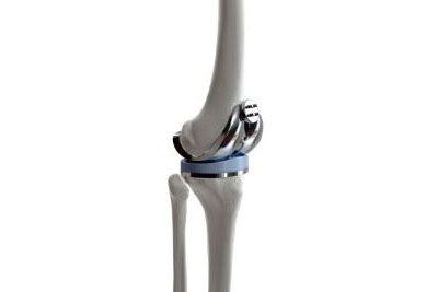 Artificial joint